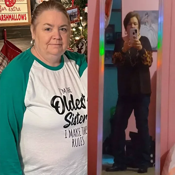 Vicki — before and after